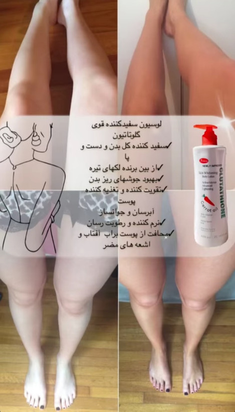 لوسیون هویچ
